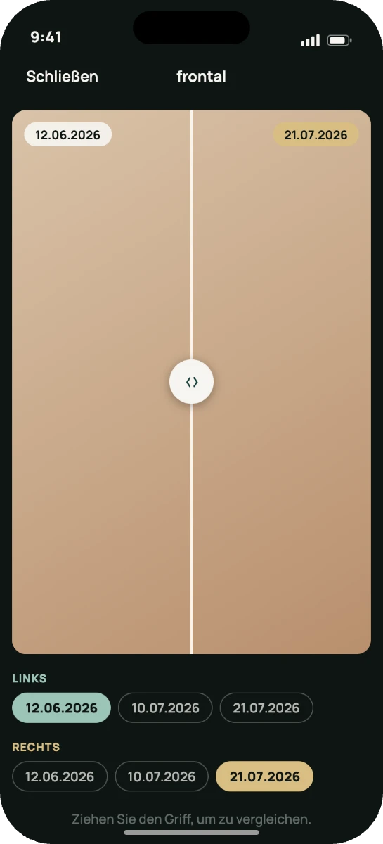 Before and after with a draggable handle, both dates picked from the series